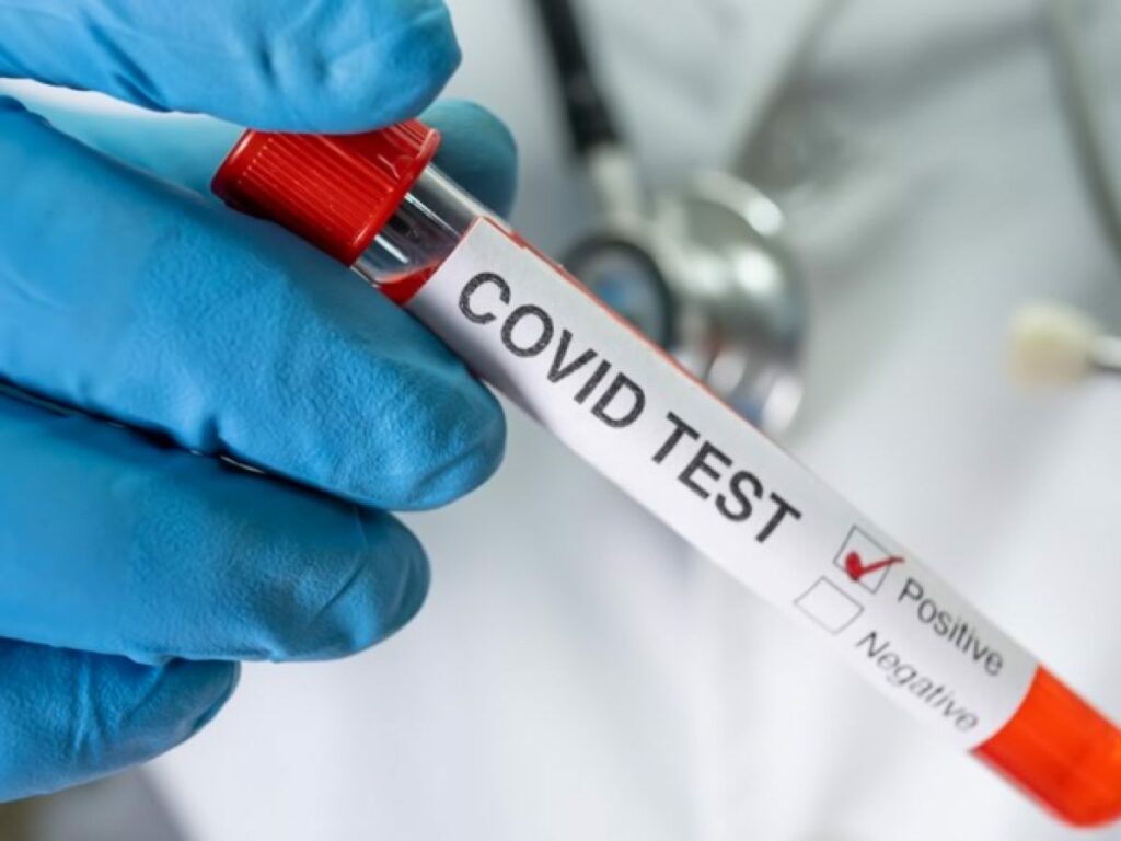 rapid covid19 testing san diego La Jolla Urgent Care Center Urgent