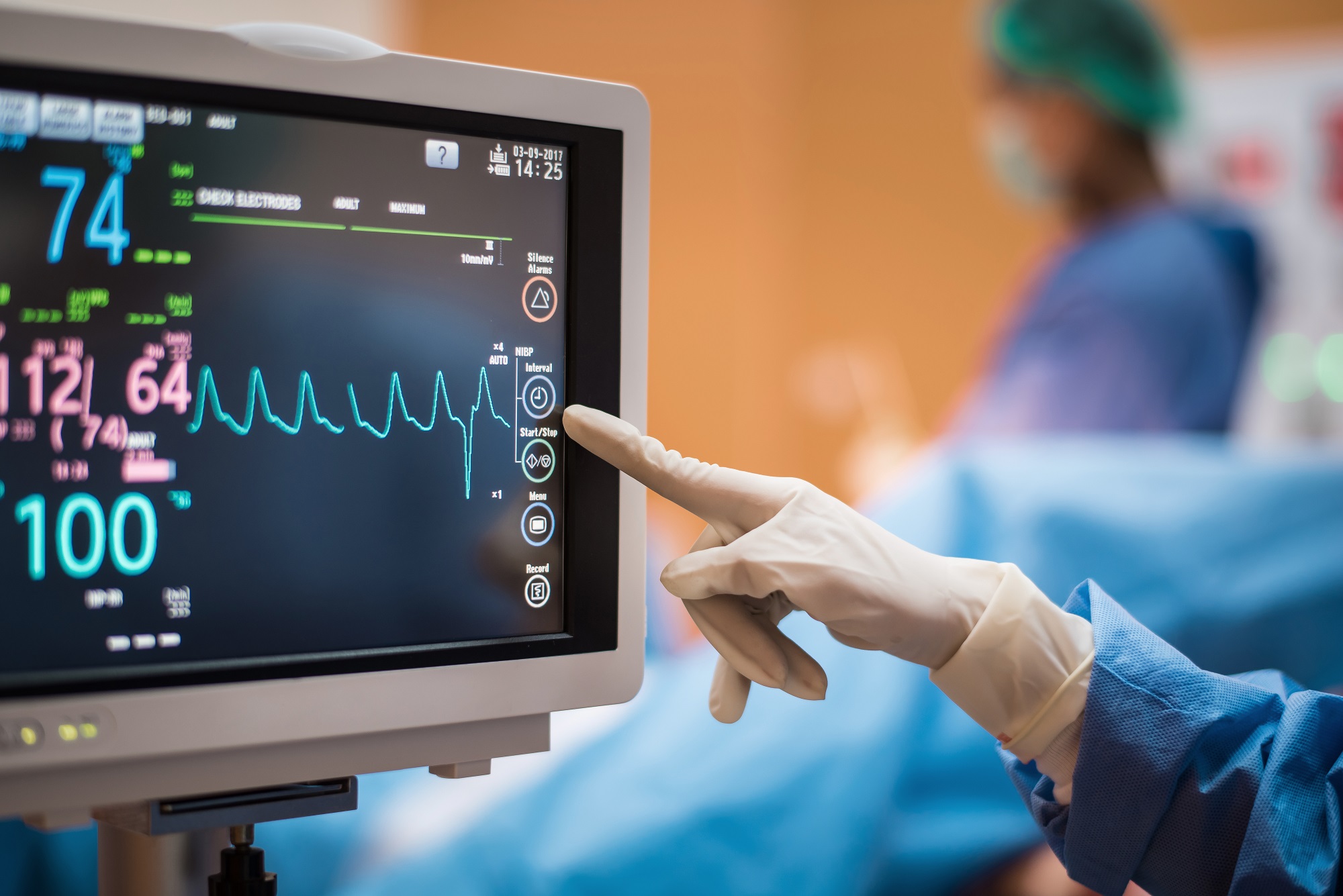 Preoperative Electrocardiogram for surgery