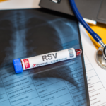 Why RSV Testing is Important
